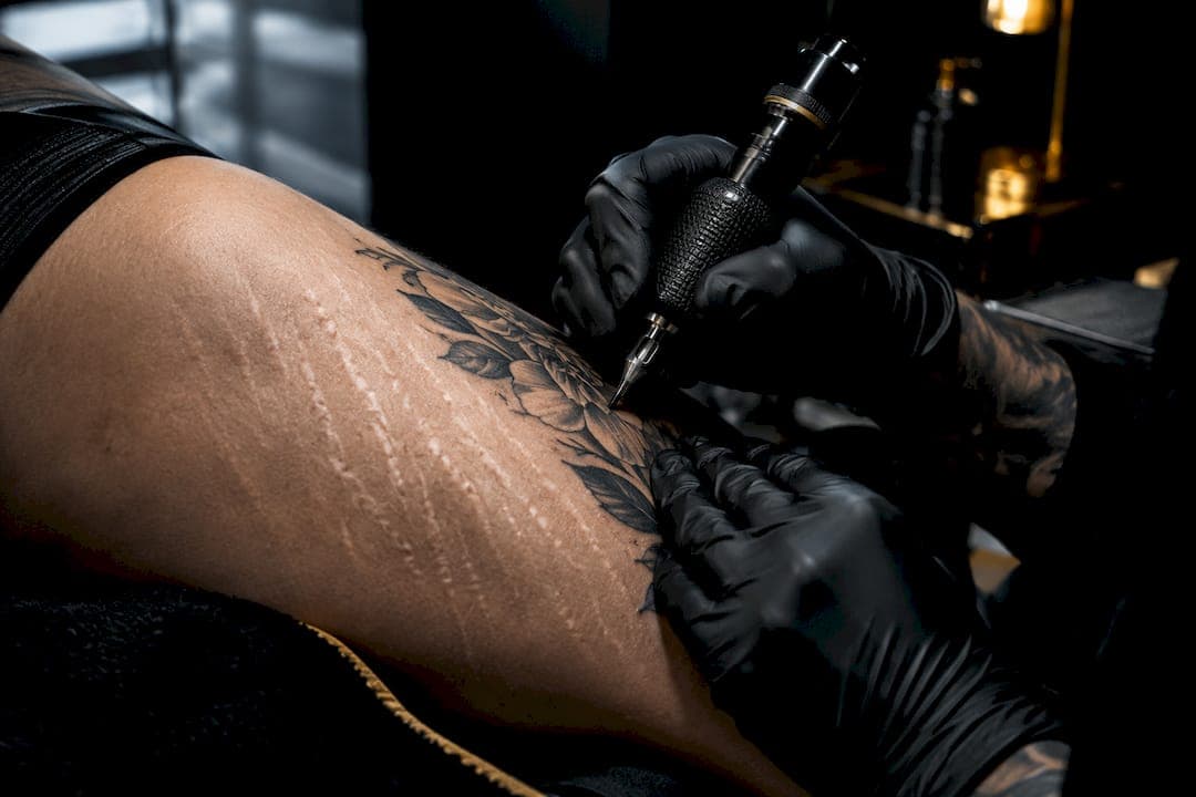 Tattoo über Dehnungsstreifen: Betäubung und Schmerzlinderung